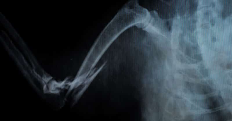Röntgenbild på en katts ben